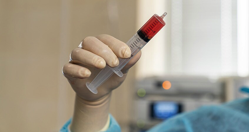 Przewlekła białaczka limfocytowa – diagnostyka, objawy, leczenie